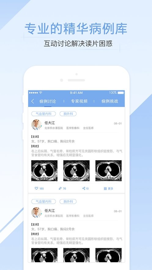 医学影像手机版